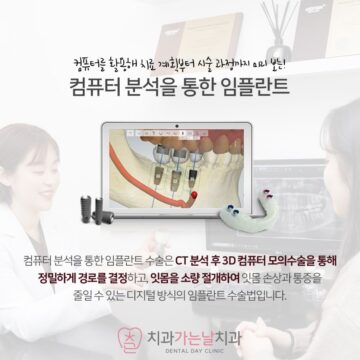 구로치과잘하는곳 복잡한 임플란트 디지털과 수면으로 편안하게