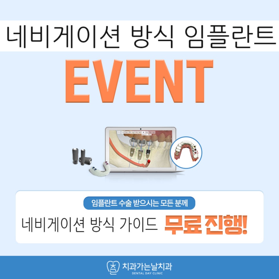 구로치과잘하는곳 복잡한 임플란트 디지털과 수면으로 편안하게